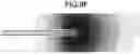 Fig. 14 - Atraumatic high-volume dental evacuation tip