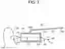 Fig. 07 - Tissue augmentation scaffolds for use in soft tissue fixation repair