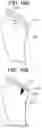 Fig. 26 - Tissue augmentation scaffolds for use in soft tissue fixation repair