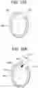 Fig. 28 - Tissue augmentation scaffolds for use in soft tissue fixation repair