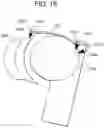 Fig. 32 - Tissue augmentation scaffolds for use in soft tissue fixation repair