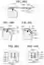 Fig. 76 - Tissue augmentation scaffolds for use in soft tissue fixation repair