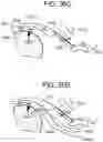 Fig. 79 - Tissue augmentation scaffolds for use in soft tissue fixation repair