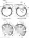 Fig. 02 - Artificial lens capsule