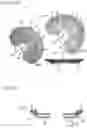 Fig. 06 - Artificial lens capsule