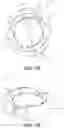 Fig. 02 - Accommodating intraocular lenses and methods of use