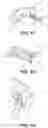 Fig. 04 - Accommodating intraocular lenses and methods of use