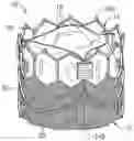 Fig. 01 - Frame for prosthetic heart valve