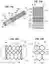 Fig. 07 - Frame for prosthetic heart valve