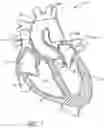 Fig. 02 - Method of Treating a Patient Using a Retrievable Transcatheter Prosthetic Heart Valve