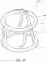 Fig. 10 - Method of Treating a Patient Using a Retrievable Transcatheter Prosthetic Heart Valve