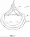 Fig. 11 - Method of Treating a Patient Using a Retrievable Transcatheter Prosthetic Heart Valve