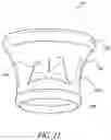 Fig. 17 - Method of Treating a Patient Using a Retrievable Transcatheter Prosthetic Heart Valve