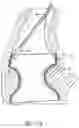 Fig. 40 - Method of Treating a Patient Using a Retrievable Transcatheter Prosthetic Heart Valve