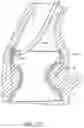 Fig. 42 - Method of Treating a Patient Using a Retrievable Transcatheter Prosthetic Heart Valve