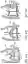 Fig. 70 - Method of Treating a Patient Using a Retrievable Transcatheter Prosthetic Heart Valve