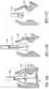 Fig. 71 - Method of Treating a Patient Using a Retrievable Transcatheter Prosthetic Heart Valve