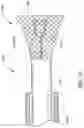 Fig. 76 - Method of Treating a Patient Using a Retrievable Transcatheter Prosthetic Heart Valve