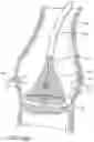 Fig. 79 - Method of Treating a Patient Using a Retrievable Transcatheter Prosthetic Heart Valve