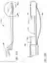 Fig. 80 - Method of Treating a Patient Using a Retrievable Transcatheter Prosthetic Heart Valve
