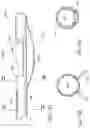 Fig. 81 - Method of Treating a Patient Using a Retrievable Transcatheter Prosthetic Heart Valve