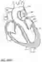 Fig. 92 - Method of Treating a Patient Using a Retrievable Transcatheter Prosthetic Heart Valve