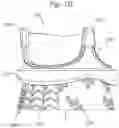 Fig. 03 - System and method for implanting and securing a bioprosthetic device to wet tissue