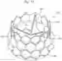 Fig. 07 - System and method for implanting and securing a bioprosthetic device to wet tissue