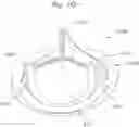 Fig. 08 - System and method for implanting and securing a bioprosthetic device to wet tissue