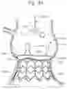Fig. 13 - System and method for implanting and securing a bioprosthetic device to wet tissue