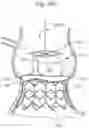 Fig. 16 - System and method for implanting and securing a bioprosthetic device to wet tissue