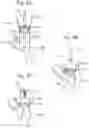 Fig. 19 - System and method for implanting and securing a bioprosthetic device to wet tissue