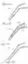 Fig. 24 - System and method for implanting and securing a bioprosthetic device to wet tissue