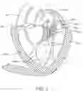 Fig. 03 - Methods and apparatus for delivering a prosthetic valve to a beating heart