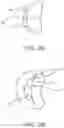 Fig. 05 - Methods and apparatus for delivering a prosthetic valve to a beating heart