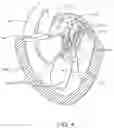 Fig. 06 - Methods and apparatus for delivering a prosthetic valve to a beating heart