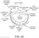 Fig. 08 - Methods and apparatus for delivering a prosthetic valve to a beating heart