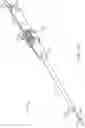 Fig. 15 - Methods and apparatus for delivering a prosthetic valve to a beating heart
