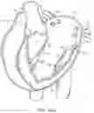 Fig. 19 - Methods and apparatus for delivering a prosthetic valve to a beating heart