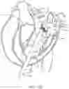 Fig. 21 - Methods and apparatus for delivering a prosthetic valve to a beating heart
