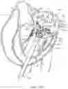 Fig. 24 - Methods and apparatus for delivering a prosthetic valve to a beating heart