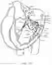 Fig. 28 - Methods and apparatus for delivering a prosthetic valve to a beating heart