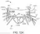 Fig. 29 - Methods and apparatus for delivering a prosthetic valve to a beating heart