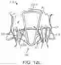 Fig. 30 - Methods and apparatus for delivering a prosthetic valve to a beating heart