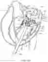 Fig. 36 - Methods and apparatus for delivering a prosthetic valve to a beating heart