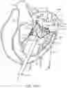 Fig. 37 - Methods and apparatus for delivering a prosthetic valve to a beating heart