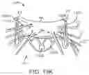 Fig. 41 - Methods and apparatus for delivering a prosthetic valve to a beating heart