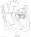 Fig. 44 - Methods and apparatus for delivering a prosthetic valve to a beating heart