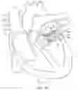 Fig. 45 - Methods and apparatus for delivering a prosthetic valve to a beating heart