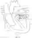 Fig. 46 - Methods and apparatus for delivering a prosthetic valve to a beating heart